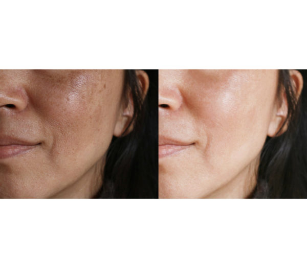 Clear Skin Oil - Lokelani Essentials - Image 2